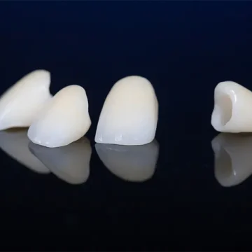 7 Signs You May Need a Dental Crown Before a Tooth Breaks